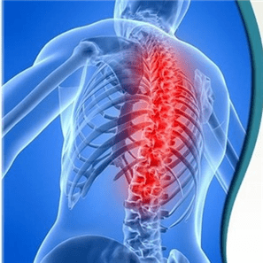 spinálna osteochondróza môže byť spôsobená rôznymi príčinami